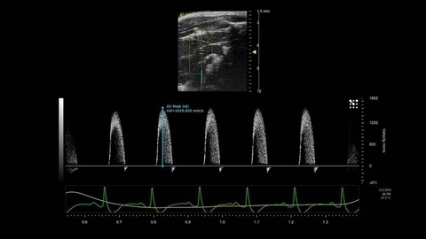 Pulsed-Wave Doppler | FUJIFILM VisualSonics